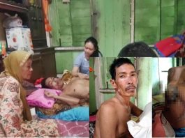 Rudi Hartono, penderita kanker ganas di Nagari Kinari, Kecamatan Bukit Sundi Kab. Solok.
